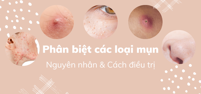 Phân biệt các loài chim đen thường gặp