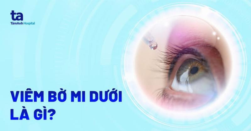 Rụng lông mi bên trái: Cẩn trọng với thị phi?